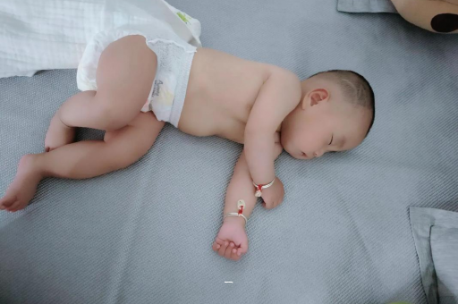 雄安新区宝宝脸上有白色斑块